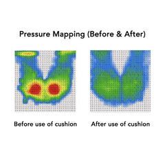 ErgoGel Pressure Relief Seat Cushion